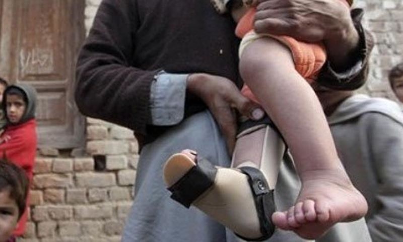 alt=" 65th polio case in Balochistan"