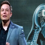 alt="Elon Musk Announces Neuralink Successfully Implanted Brain Device in Third Patient"