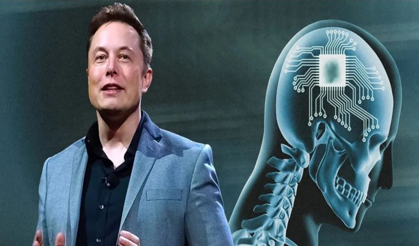 alt="Elon Musk Announces Neuralink Successfully Implanted Brain Device in Third Patient"