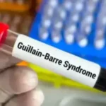 alt="Rare Guillain-Barré Syndrome Outbreak Hits Pune, India"