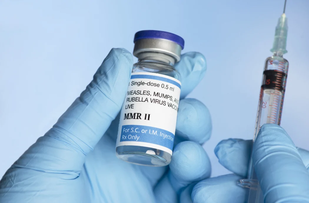 alt="Measles Outbreak in U.S. Claims Two Lives, Nearly 230 Infected"