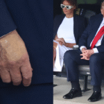 alt="Donald Trump's Leg Illness Draws Attention to UAE Workers' Risks"