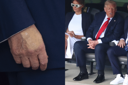 alt="Donald Trump's Leg Illness Draws Attention to UAE Workers' Risks"