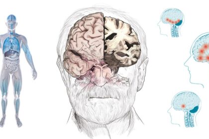 alt="breakthrough-technique-maps-toxic-protein-growth-in-alzheimers-disease"